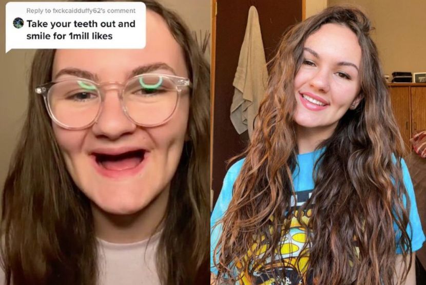 Wanita Tak Segan Tanggalkan Gigi Palsu Di Tiktok Demi Beri Kesedaran Tentang Bahaya Penyalahgunaan Dadah Dunia Mstar