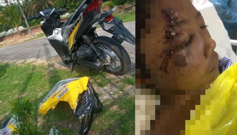 Saya Sempat Pesan Jangan Merayau Beli Motor Nak Mudah Urusan Malang Pula Menimpa Pekerja Kilang Buntu Fikir Kos Rawatan Adik Kemalangan Viral Mstar