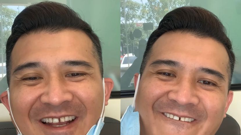 [VIDEO] Aaron Aziz dipuji masih kacak walaupun gigi rongak - Hiburan ...