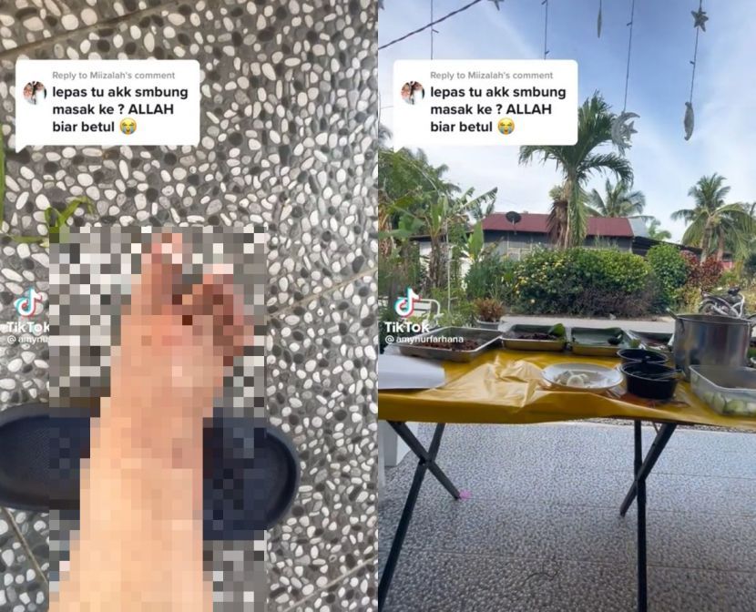 Amy melecur pada kaki akibat terkena api dalam kejadian itu.
