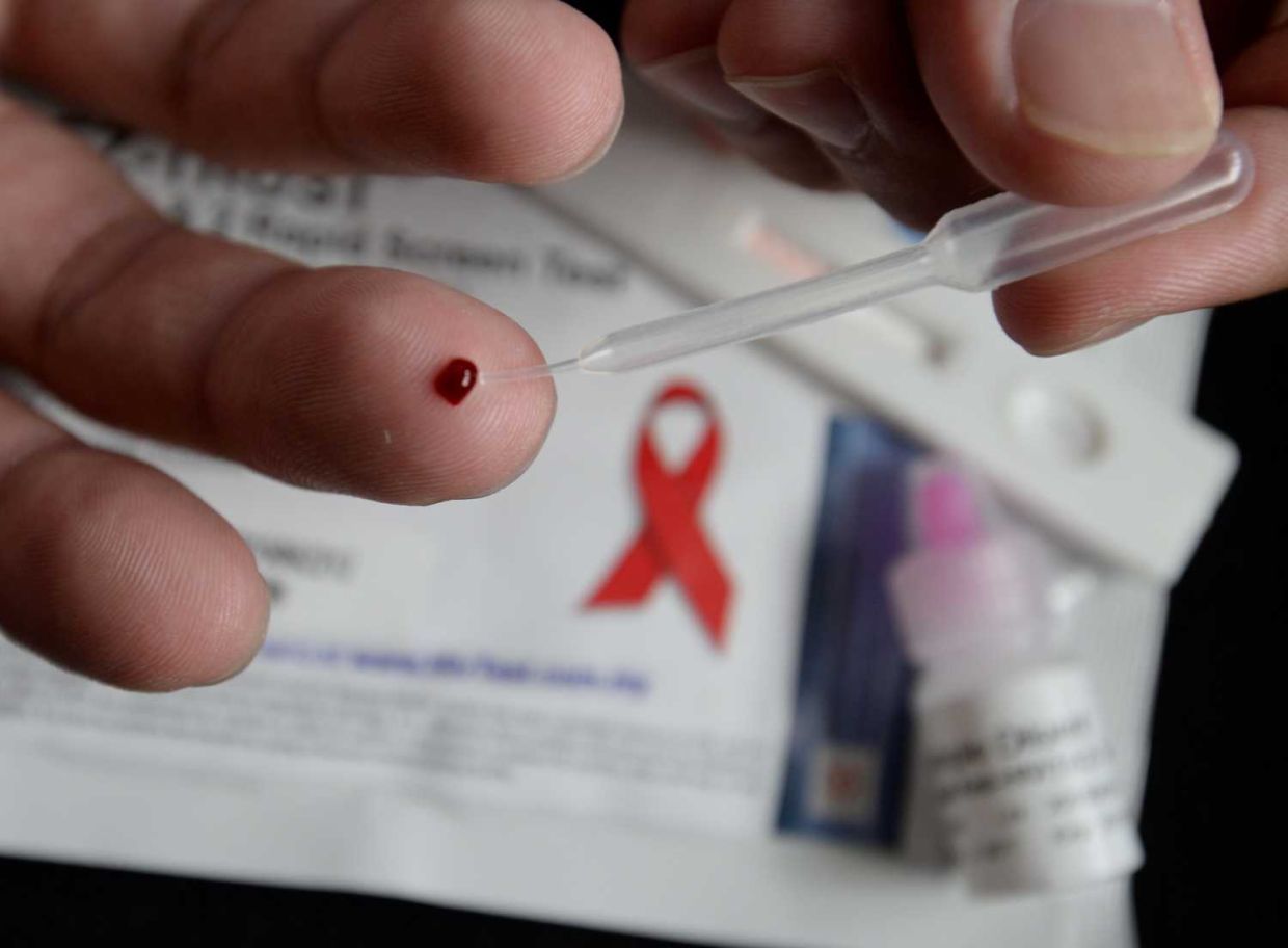 HIV test.
