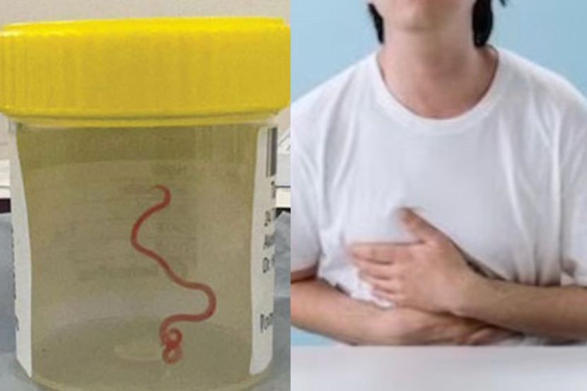 Sakit perut antara tanda-tanda dijangkiti cacing. -Gambar hiasan