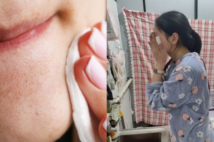 Wanita amat mementingkan kebersihan kulit wajah. -Gambar hiasan