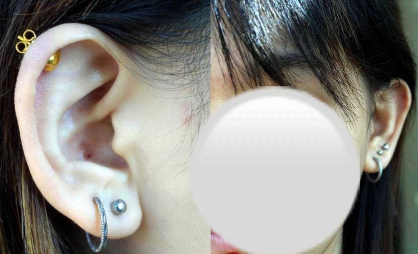 Tindik telinga popular dalam kalangan wanita dan kanak-kanak. -Gambar hiasan