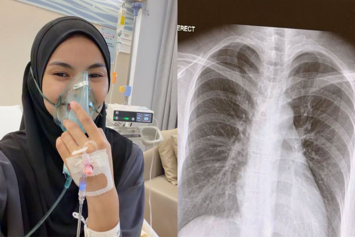 Batuk berterusan hingga sebulan, Mia Azhar rupanya alami jangkitan ...