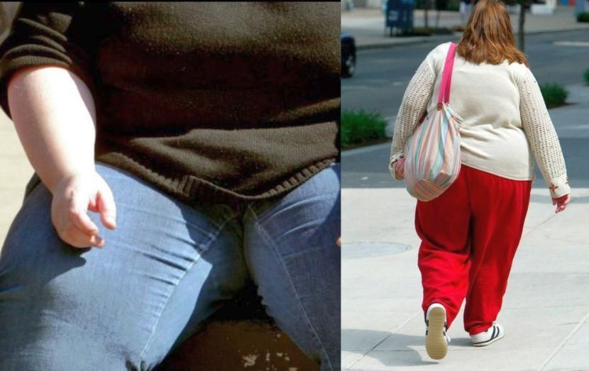 Individu berbadan gempal sering mengalami masalah kesihatan. -Gambar hiasan