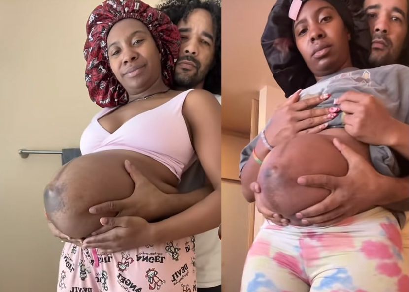 Wanita ini disahkan hamil anak kembar selepas melakukan ultrabunyi pada usia kandungan tujuh bulan berikutan bentuk perutnya yang semakin besar dan berat. -Foto TikTok FunFact