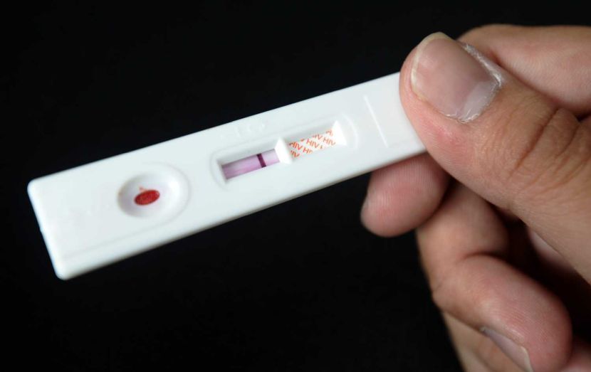 HIV test.